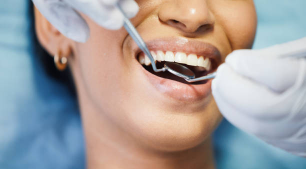 Best Root Canal Emergency Dentist  in Rosedale, CA